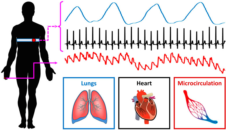 Linear and Nonlinear Directed Connectivity Analysis of the Cardio-Respiratory System in Type 1 Diabetes